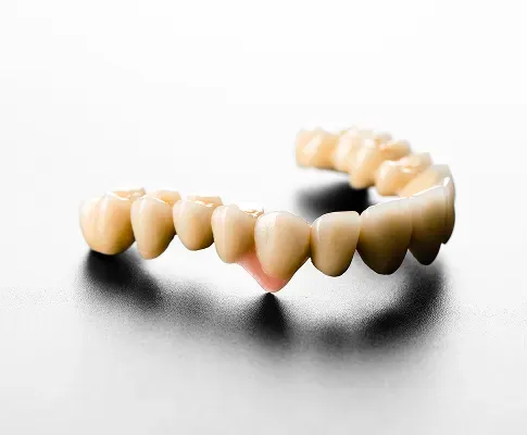 How Dental Bridges Prevent Jawbone Loss and Maintain Facial Structure?